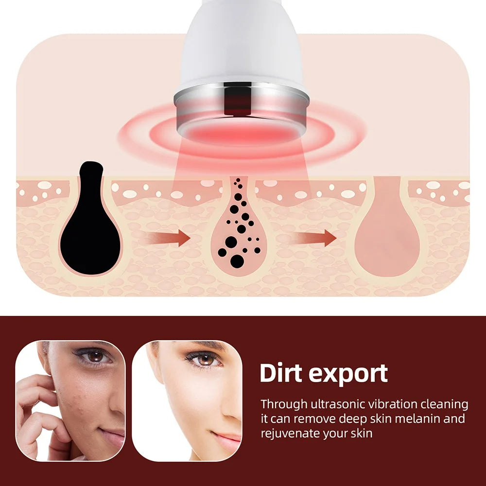 Ultrasonic Facial Beauty Device